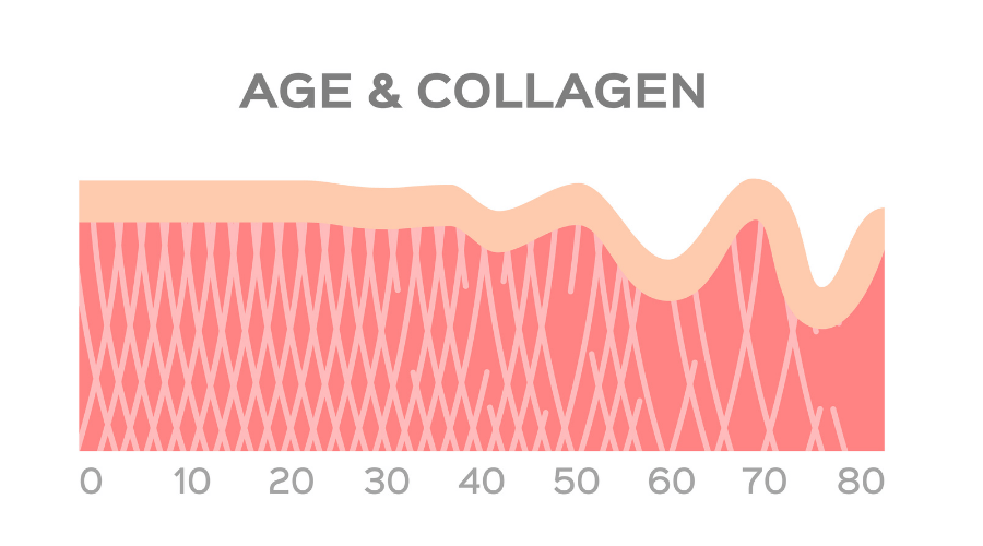Age Kollagen